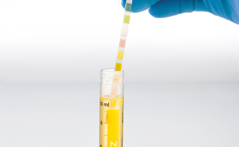Urin-Monovette mit Teststreifen