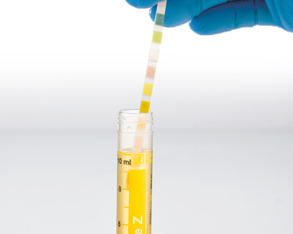 Urin-Monovette mit Teststreifen